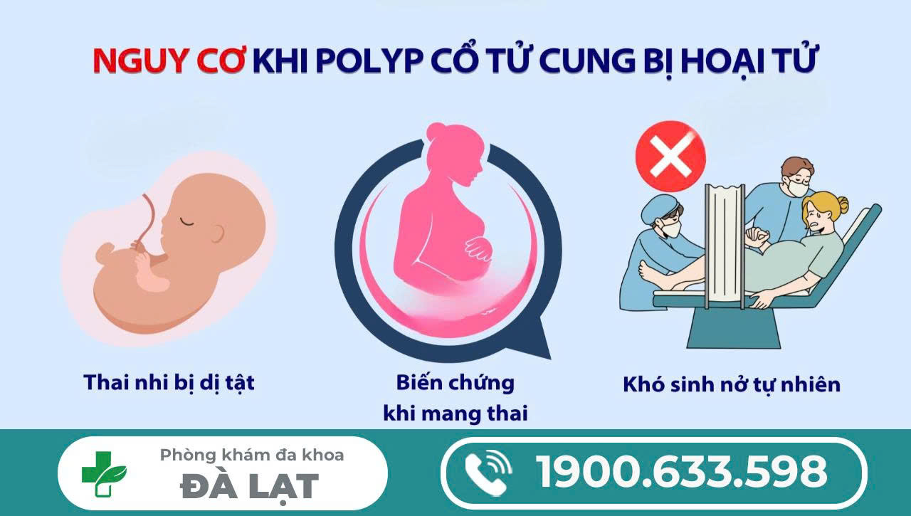 Hình ảnh minh họa